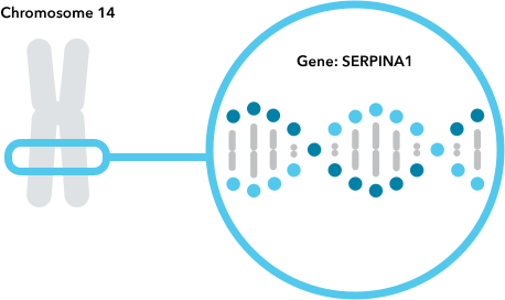 Is Alpha-1 Antitrypsin Deficiency Genetic?